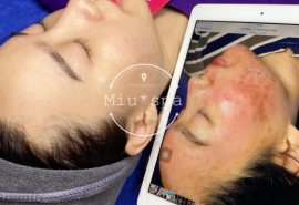 Top 7 Spa trị mụn hiệu quả nhất Đà Nẵng