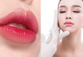 Top 3 Địa chỉ tiêm môi đẹp và uy tín nhất Đà Nẵng